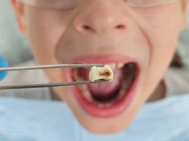 Best Emergency Gum Pain Relief  in Prien, LA